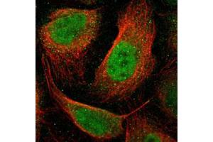 Immunofluorescent staining of U-2 OS with RARB polyclonal antibody  (Green) shows positivity in nucleus but excluded from the nucleoli. (Retinoic Acid Receptor beta anticorps)