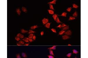 Immunofluorescence analysis of HeLa cells using BNIP3 Polyclonal Antibody at dilution of 1:100.