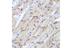 Immunohistochemistry of paraffin-embedded Rat heart using Connexin 43 Rabbit pAb (ABIN6131701, ABIN6141098, ABIN6141099 and ABIN6215448) at dilution of 1:100 (40x lens).