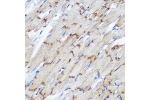 Immunohistochemistry of paraffin-embedded Rat heart using Connexin 43 Rabbit pAb (ABIN6131701, ABIN6141098, ABIN6141099 and ABIN6215448) at dilution of 1:100 (40x lens). (Connexin 43/GJA1 anticorps  (AA 233-382))
