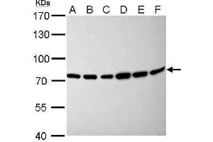 WB Image Moesin antibody [C2C3], C-term detects MSN protein by Western blot analysis. (Moesin anticorps  (C-Term))