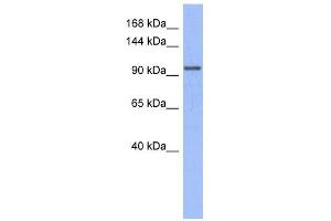 MSH4 antibody used at 1 ug/ml to detect target protein. (MSH4 anticorps)