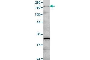 COL5A1 monoclonal antibody (M01), clone 2F4 Western Blot analysis of COL5A1 expression in Hela S3 NE . (COL5A1 anticorps  (AA 1-591))