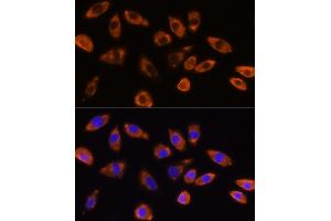 Immunofluorescence analysis of L929 cells using GNB1 Rabbit pAb (ABIN6129389, ABIN6141219, ABIN6141220 and ABIN6219000) at dilution of 1:100 (40x lens). (GNB1 anticorps  (AA 1-340))