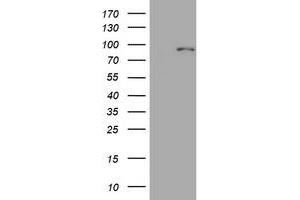 Image no. 1 for anti-Mitofusin 1 (MFN1) (AA 209-469) antibody (ABIN1491184) (MFN1 anticorps  (AA 209-469))