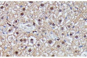 Immunohistochemistry of paraffin-embedded Mouse liver using IGHMBP2 Polyclonal Antibody at dilution of 1:100 (40x lens). (IGHMBP2 anticorps)