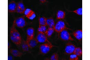 Immunofluorescence staining of vesicles (red) in RBL-2H3 rat basophilic leukemia cell line using anti-Kinesin (KN-03). (Kinesin (heavy chain) anticorps)