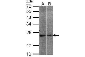 WB Image Sample(30 μg of whole cell lysate) A:A431, B:Hep G2, 12% SDS PAGE antibody diluted at 1:200 (NCS1 anticorps)