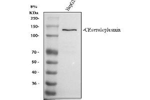Western blot analysis of Ceruloplasmin using anti-Ceruloplasmin antibody (ABIN3044507).