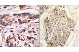 Image no. 2 for anti-Melanoma Antigen Family A, 1 (Directs Expression of Antigen MZ2-E) (MAGEA1) (Middle Region) antibody (ABIN358644)