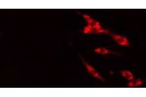 ABIN6275451 staining HeLa cells by IF/ICC. (G3BP2 anticorps  (C-Term))