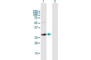 Western Blot analysis of SIRT5 expression in transfected 293T cell line by SIRT5 MaxPab polyclonal antibody. (SIRT5 anticorps  (AA 1-310))