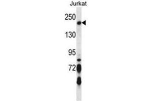 BRIP1 Antibody (N-term) western blot analysis in Jurkat cell line lysates (35µg/lane).