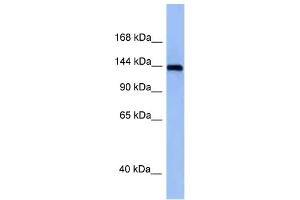WB Suggested Anti-Tnik Antibody Titration: 1. (TNIK anticorps  (Middle Region))