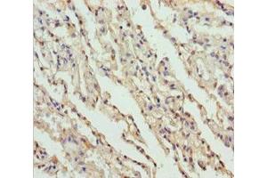 Immunohistochemistry of paraffin-embedded human lung tissue using ABIN7149964 at dilution of 1:100 (FMO5 anticorps  (AA 1-285))