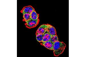 Confocal immunofluorescent analysis of CTNNB1 Antibody (N-term) with T47D cell followed by Alexa Fluor 488-conjugated goat anti-rabbit lgG (green).