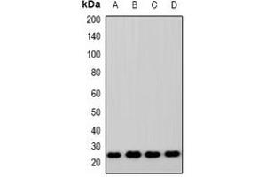 Western blot analysis of ZNRF2 expression in HEK293T (A), A549 (B), RAW264. (ZNRF2 anticorps  (C-Term))