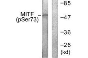 Western blot analysis of extracts from COS7 cells, using MITF (Phospho-Ser180/73) Antibody. (MITF anticorps  (pSer180))