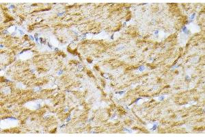 Immunohistochemistry of paraffin-embedded Rat heart using SLC25A5 Polyclonal Antibody at dilution of 1:100 (40x lens). (SLC25A5 anticorps)