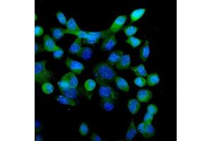 IF analysis of eRF1/ETF1 using anti-eRF1/ETF1 antibody (ABIN7602626). (ETF1 anticorps  (AA 9-342))