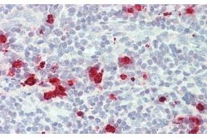 Detection of GZMM in Human Tonsil Tissue using Monoclonal Antibody to Granzyme M (GZMM)