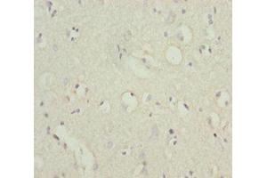 IHC analysis of paraffin-embedded human brain tissue, using POU4F3 antibody (1/100 dilution).