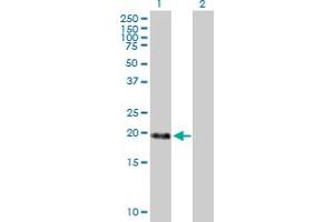 Western Blot analysis of MBD3L1 expression in transfected 293T cell line by MBD3L1 MaxPab polyclonal antibody. (MBD3L1 anticorps  (AA 1-194))