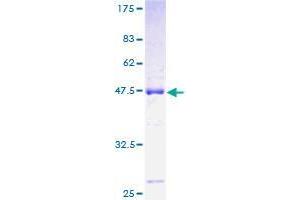 Image no. 1 for Roundabout, Axon Guidance Receptor, Homolog 3 (ROBO3) (AA 1-147) protein (GST tag) (ABIN1318429)