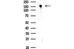 Western blot analysis of lysates from EC304 cells, using Phospho-EGFR (Ser1026) Antibody at 1/1000 dilution.