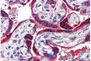 Human Placenta (formalin-fixed, paraffin-embedded) stained with PPARG antibody ABIN351540 at 2.