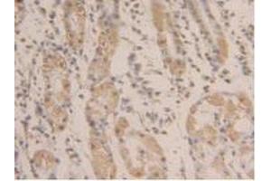 Detection of GAPDH in Human Stomach Tissue using Polyclonal Antibody to Glyceraldehyde-3-Phosphate Dehydrogenase (GAPDH) (GAPDH anticorps  (AA 154-324))