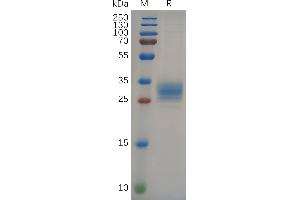 Human F Protein, His Tag on SDS-PAGE under reducing condition.