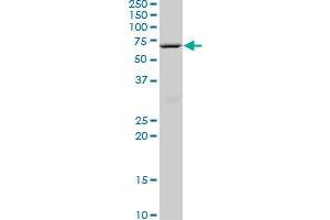 HNF4A monoclonal antibody (M07), clone 3C6. (HNF4A anticorps  (AA 324-423))