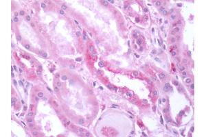 Human Kidney: Formalin-Fixed, Paraffin-Embedded (FFPE)