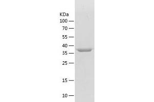 Western Blotting (WB) image for Peptidylprolyl Isomerase D (PPID) (AA 2-370) protein (His tag) (ABIN7124349)