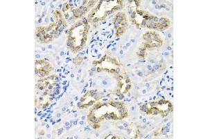 Immunohistochemistry of paraffin-embedded rat kidney using CDC antibody (ABIN6127612, ABIN6138273, ABIN6138274 and ABIN6216282) at dilution of 1:100 (40x lens).