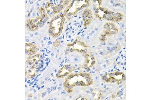 Immunohistochemistry of paraffin-embedded rat kidney using CDC antibody (ABIN6127612, ABIN6138273, ABIN6138274 and ABIN6216282) at dilution of 1:100 (40x lens). (CDCA8 anticorps  (AA 1-280))