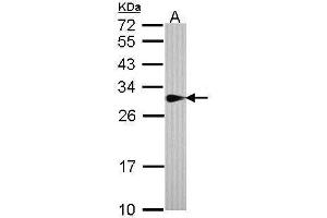 WB Image Sample (30 ug of whole cell lysate) A: A431 , 12% SDS PAGE antibody diluted at 1:1000 (SPR anticorps)