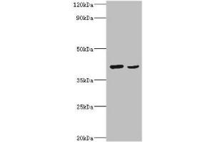 Western blot All lanes: Protein Wnt-2 antibody at 2 μg/mL Lane 1: HepG2 whole cell lysate Lane 2: MCF-7 whole cell lysate Secondary Goat polyclonal to rabbit IgG at 1/10000 dilution Predicted band size: 40 kDa Observed band size: 40 kDa (WNT2 anticorps  (AA 26-360))