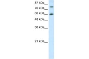 Western Blotting (WB) image for anti-Cleavage Stimulation Factor, 3' Pre-RNA, Subunit 3, 77kDa (CSTF3) antibody (ABIN2462105) (CSTF3 anticorps)