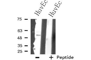 Western blot analysis of extracts from HuvEc cells using SUPT3 antibody. (SUPT3H/SPT3 anticorps  (Internal Region))