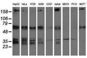 Image no. 2 for anti-Insulin-Like Growth Factor 2 mRNA Binding Protein 2 (IGF2BP2) antibody (ABIN1498825) (IGF2BP2 anticorps)