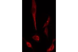 ABIN6274965 staining  Hela cells by IF/ICC. (CBR3 anticorps  (C-Term))