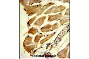Formalin-fixed and paraffin-embedded human skeletal muscle reacted with FHL1 Antibody (C-term), which was peroxidase-conjugated to the secondary antibody, followed by DAB staining.