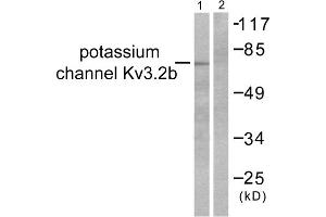 Western blot analysis of extracts from HepG2 cells, using Potassium Channel Kv3. (Kv3.2b Potassium Channel anticorps  (C-Term))