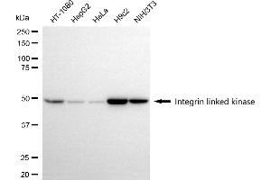 Western blotting analysis using integrin linked kinase antibody (ABIN7799075).