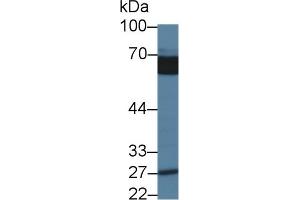 Detection of ABI1 in Porcine Cerebrum lysate using Polyclonal Antibody to Abl Interactor 1 (ABI1)