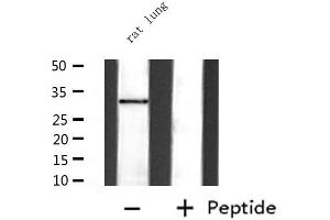 Western blot analysis of extracts from rat lung, using STAR  Antibody. (STAR anticorps  (Internal Region))