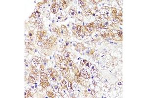Immunohistochemistry of paraffin-embedded human liver using CYP3 antibody (ABIN3023345, ABIN3023346, ABIN3023347 and ABIN6219639) at dilution of 1:100 (40x lens). (CYP3A4 anticorps  (AA 244-503))