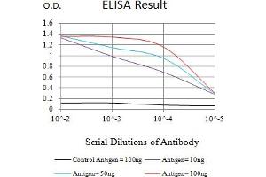 Black line: Control Antigen (100 ng),Purple line: Antigen (10 ng), Blue line: Antigen (50 ng), Red line:Antigen (100 ng)